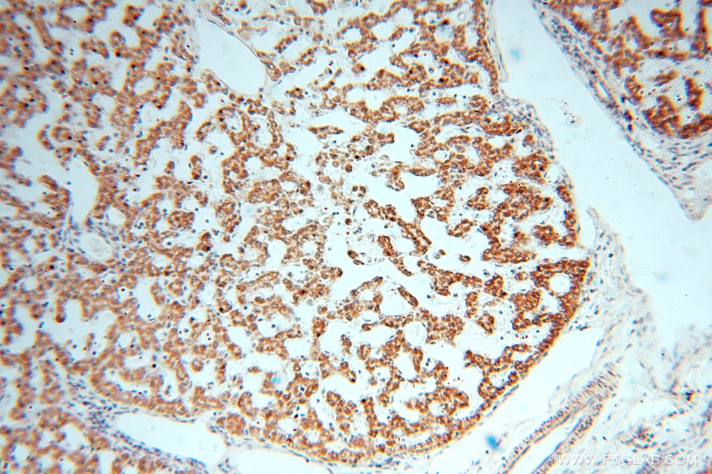 Immunohistochemistry (IHC) staining of human liver tissue using CLPP Polyclonal antibody (15698-1-AP)