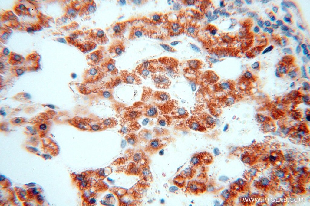 Immunohistochemistry (IHC) staining of human liver tissue using CLPP Polyclonal antibody (15698-1-AP)