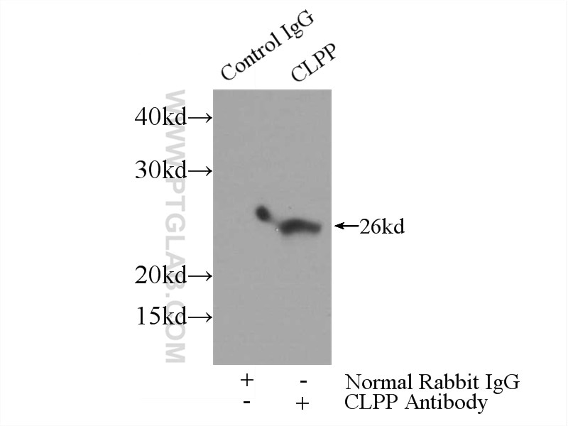 Immunoprecipitation (IP) experiment of mouse skeletal muscle tissue using CLPP Polyclonal antibody (15698-1-AP)