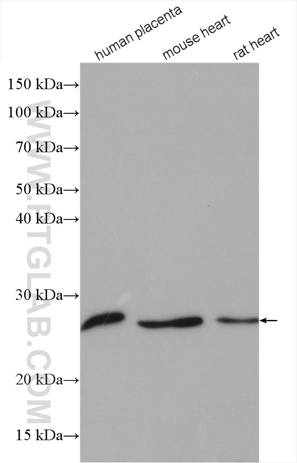 Western Blot (WB) analysis of various lysates using CLPP Polyclonal antibody (15698-1-AP)