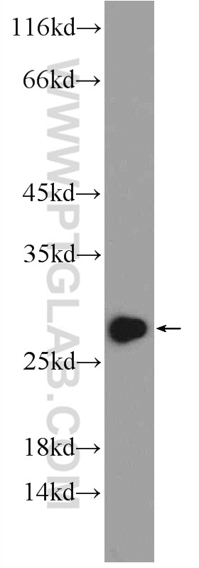 Western Blot (WB) analysis of rat heart tissue using CLPP Polyclonal antibody (15698-1-AP)