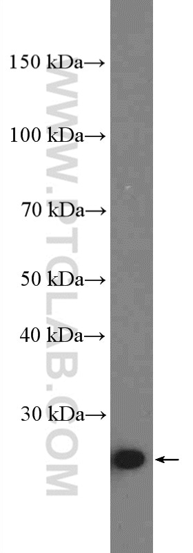 Western Blot (WB) analysis of K-562 cells using CLPP Polyclonal antibody (15698-1-AP)