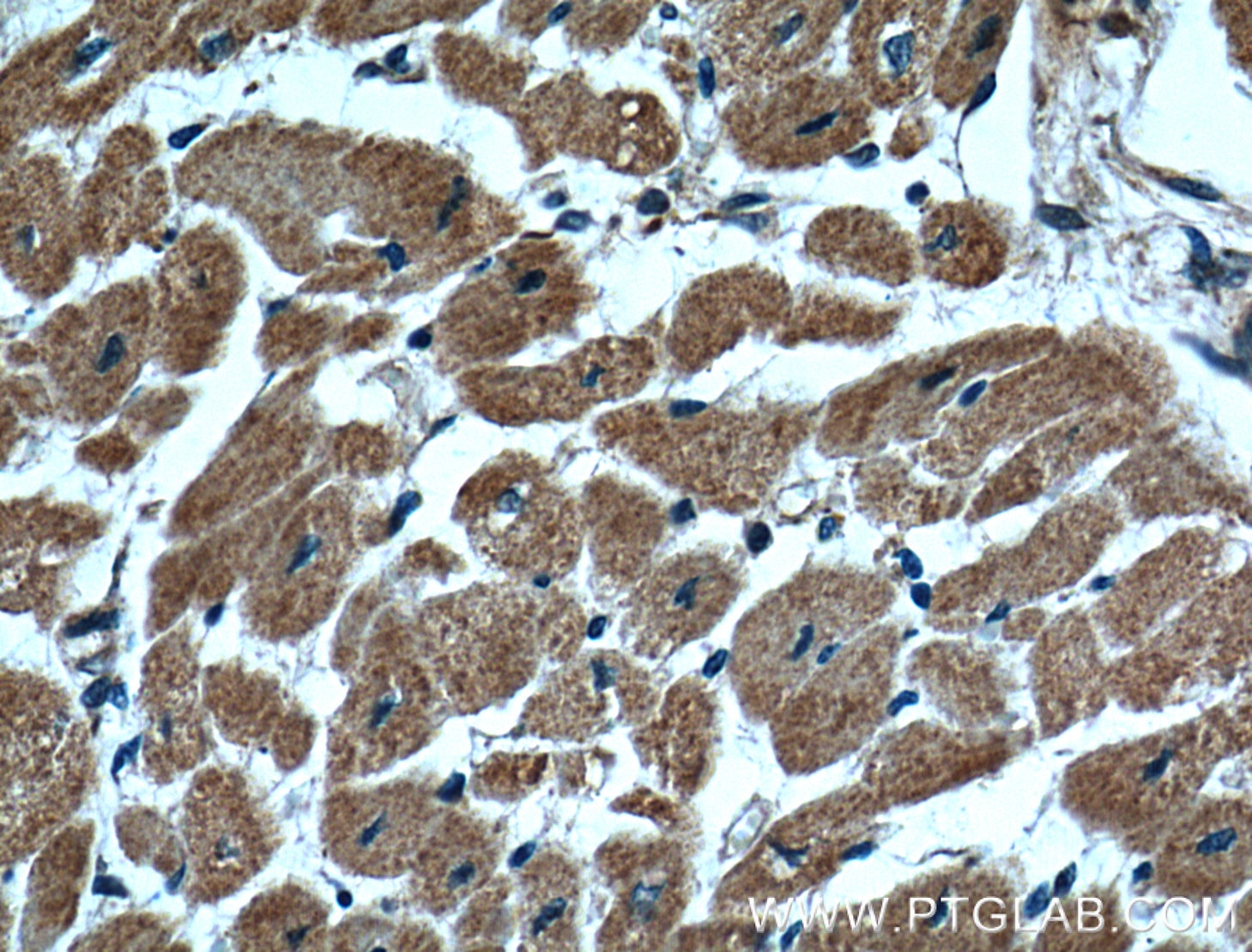 Immunohistochemistry (IHC) staining of human heart tissue using CLPP Monoclonal antibody (66271-1-Ig)