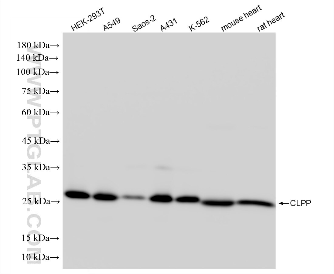 Western Blot (WB) analysis of various lysates using CLPP Recombinant monoclonal antibody (87187-3-RR)