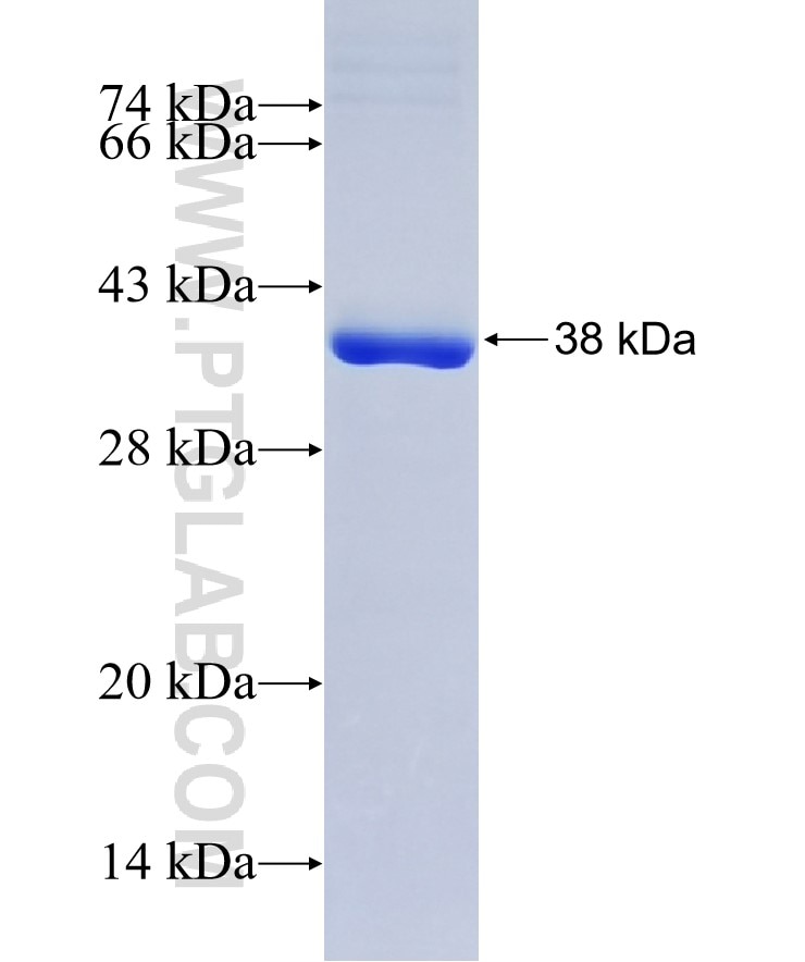 CLPP fusion protein Ag8420 SDS-PAGE