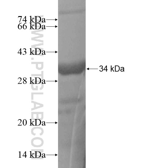 CLPTM1L fusion protein Ag19278 SDS-PAGE