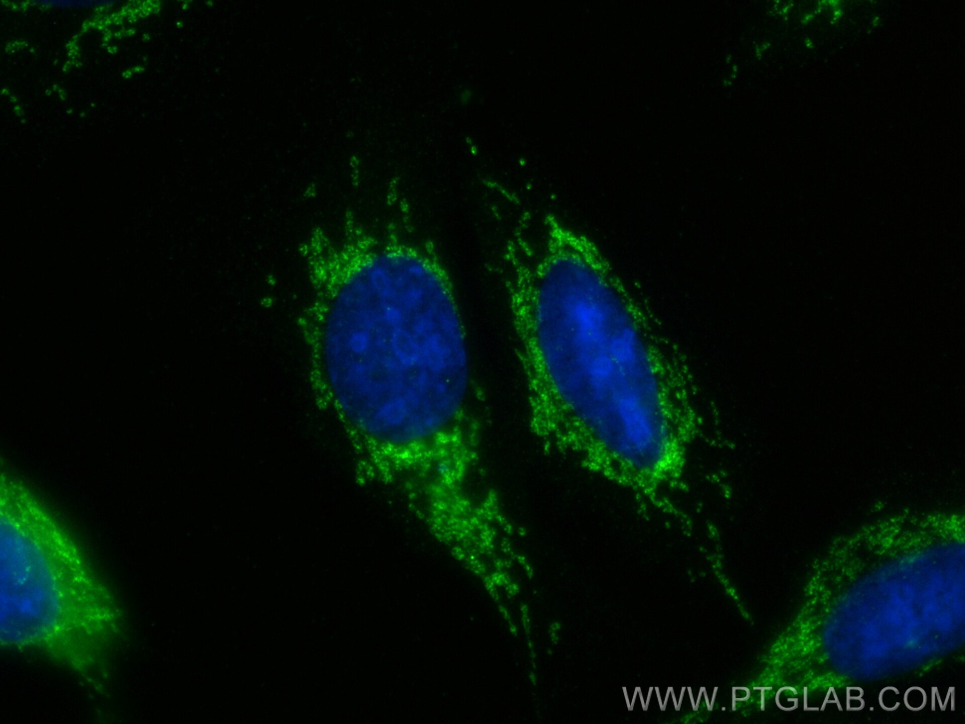 Immunofluorescent analysis of (-20°C Ethanol) fixed U2OS cells using CLPX antibody (83097-1-RR, Clone: 230346H1 ) at dilution of 1:200 and CoraLite®488-Conjugated Goat Anti-Rabbit IgG(H+L) (SA00013-2). This data was developed using the same antibody clone with 83097-1-PBS in a different storage buffer formulation. Immunofluorescence (IF) / fluorescent staining of U2OS cells using CLPX Recombinant monoclonal antibody (83097-1-RR)