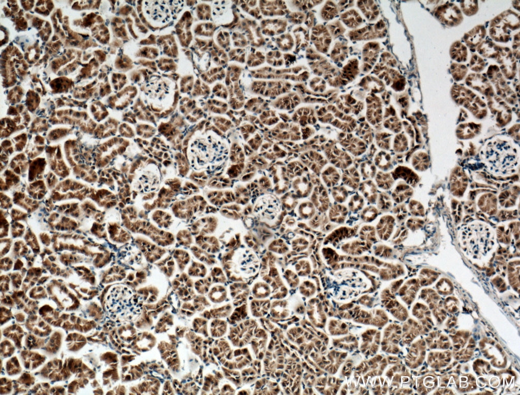 Immunohistochemistry (IHC) staining of mouse kidney tissue using CLRN1 Polyclonal antibody (26630-1-AP)