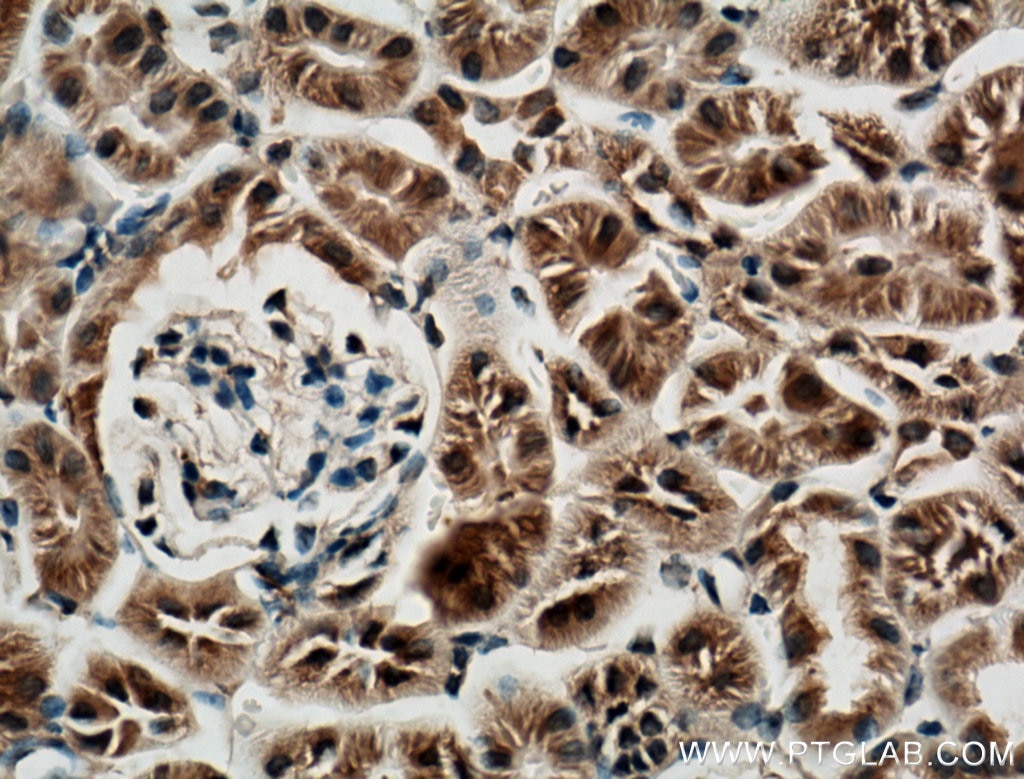 Immunohistochemistry (IHC) staining of mouse kidney tissue using CLRN1 Polyclonal antibody (26630-1-AP)