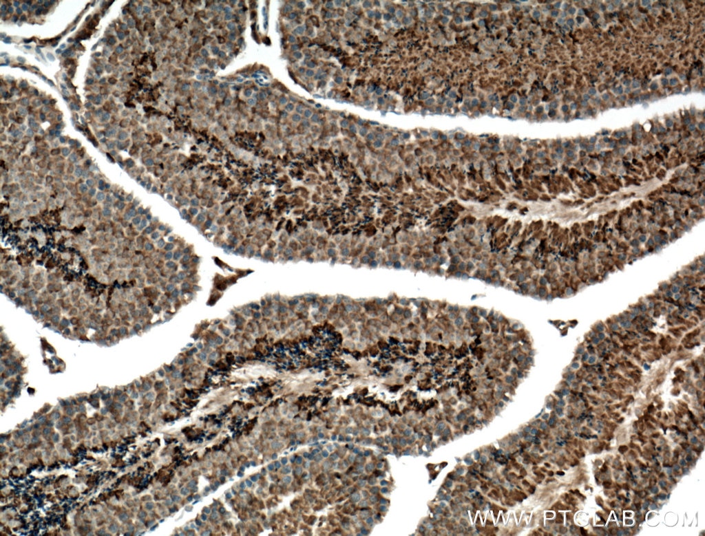Immunohistochemistry (IHC) staining of mouse testis tissue using CLRN1 Polyclonal antibody (26630-1-AP)