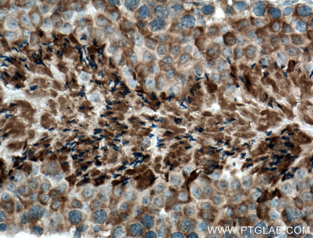 Immunohistochemistry (IHC) staining of mouse testis tissue using CLRN1 Polyclonal antibody (26630-1-AP)