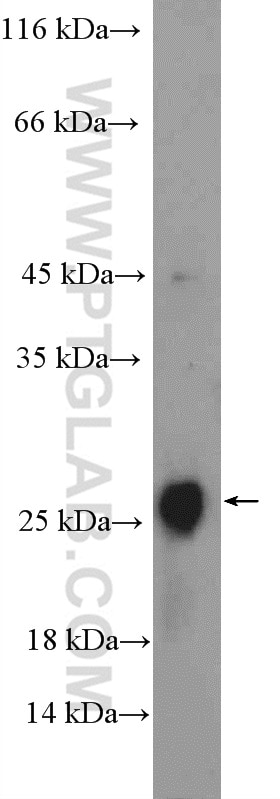 Western Blot (WB) analysis of mouse eye tissue using CLRN2 Polyclonal antibody (23994-1-AP)