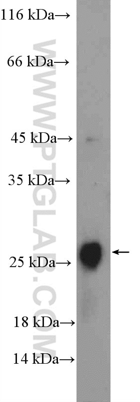 WB analysis of mouse eye using 23994-1-AP