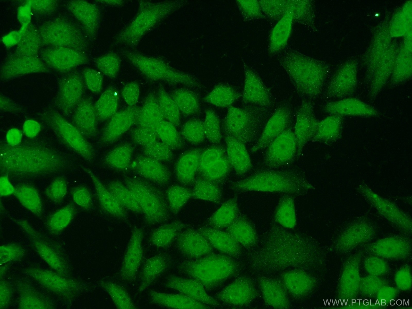 Immunofluorescence (IF) / fluorescent staining of HeLa cells using Claspin Polyclonal antibody (23206-1-AP)