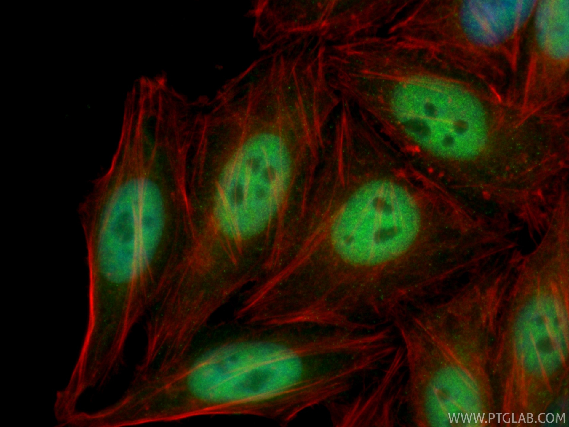 IF Staining of HepG2 using 23206-1-AP Immunofluorescence (IF) / fluorescent staining of HepG2 cells using Claspin Polyclonal antibody (23206-1-AP)