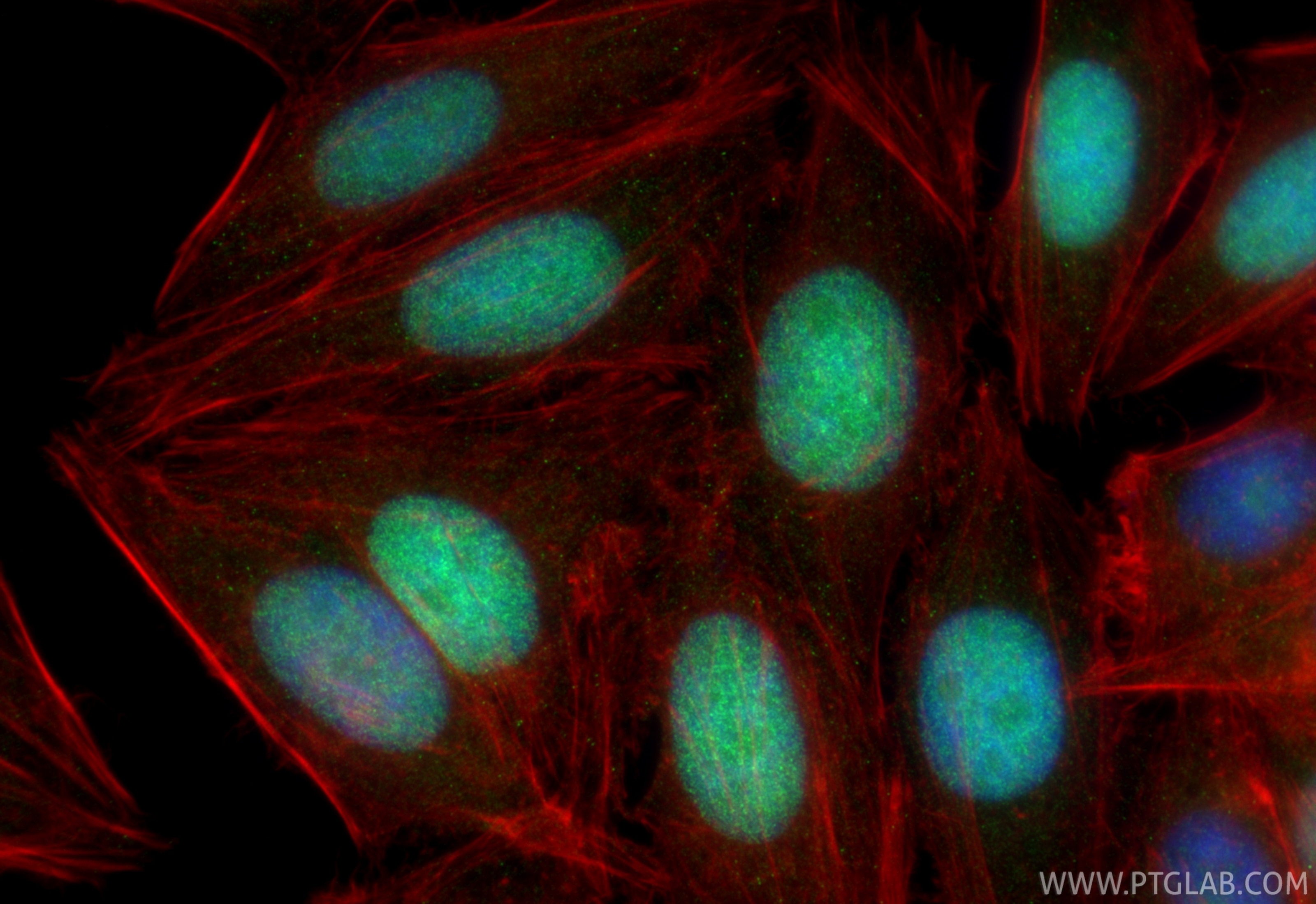 IF Staining of HepG2 using 23206-1-AP Immunofluorescence (IF) / fluorescent staining of HepG2 cells using Claspin Polyclonal antibody (23206-1-AP)