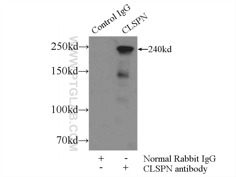 Immunoprecipitation (IP) experiment of HEK-293 cells using Claspin Polyclonal antibody (23206-1-AP)