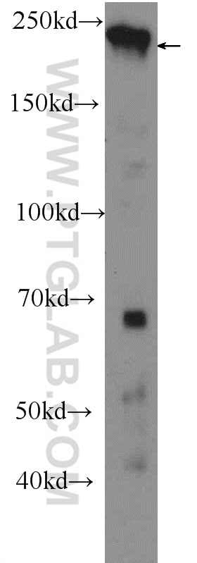 Western Blot (WB) analysis of HEK-293 cells using Claspin Polyclonal antibody (23206-1-AP)