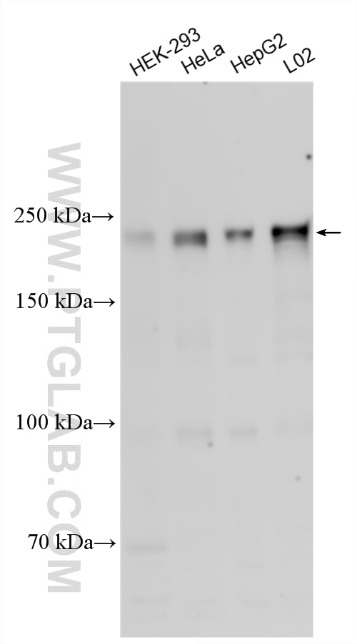 Western Blot (WB) analysis of various lysates using Claspin Polyclonal antibody (23206-1-AP)