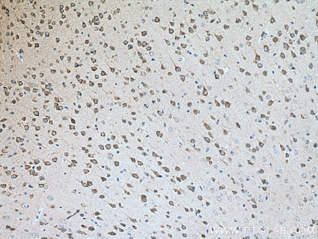 Immunohistochemistry (IHC) staining of mouse brain tissue using Calsyntenin-1 Polyclonal antibody (12788-1-AP)