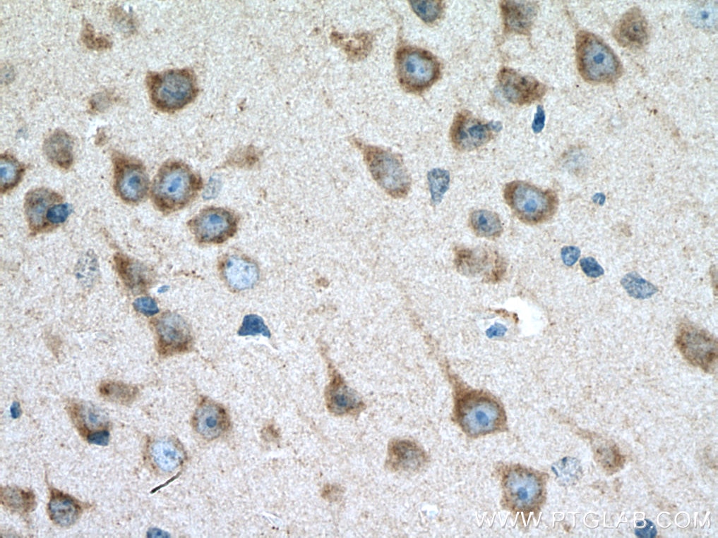 Immunohistochemistry (IHC) staining of mouse brain tissue using Calsyntenin-1 Polyclonal antibody (12788-1-AP)