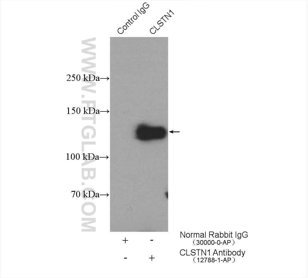 Immunoprecipitation (IP) experiment of mouse brain tissue using Calsyntenin-1 Polyclonal antibody (12788-1-AP)