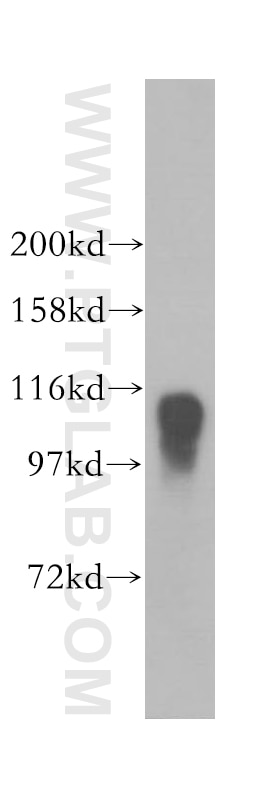 Western Blot (WB) analysis of human brain tissue using Calsyntenin-1 Polyclonal antibody (12788-1-AP)