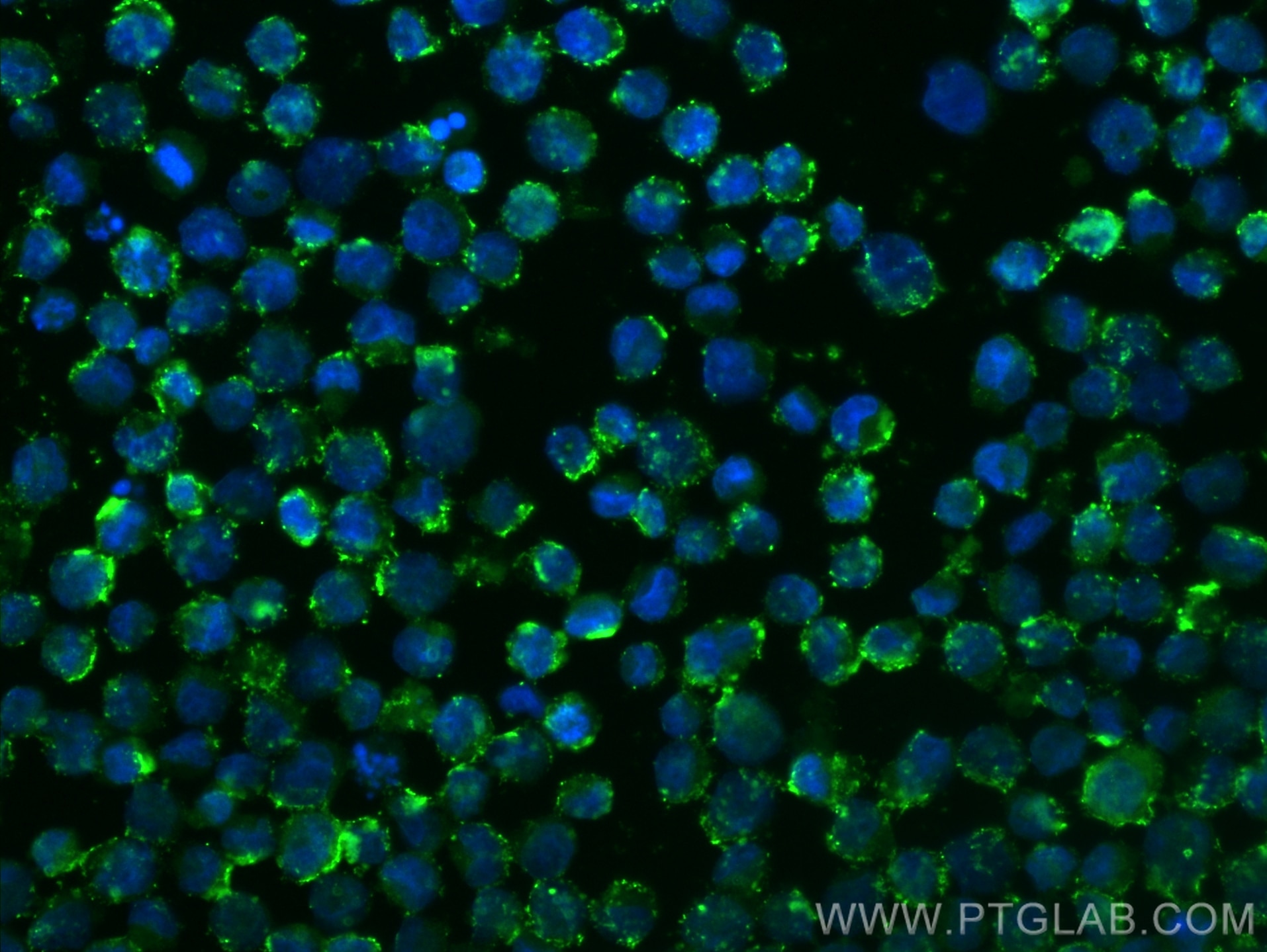 Immunofluorescence (IF) / fluorescent staining of K-562 cells using CLSTN2 Polyclonal antibody (21436-1-AP)