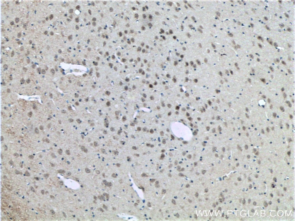 Immunohistochemistry (IHC) staining of mouse brain tissue using CLSTN2 Polyclonal antibody (21436-1-AP)