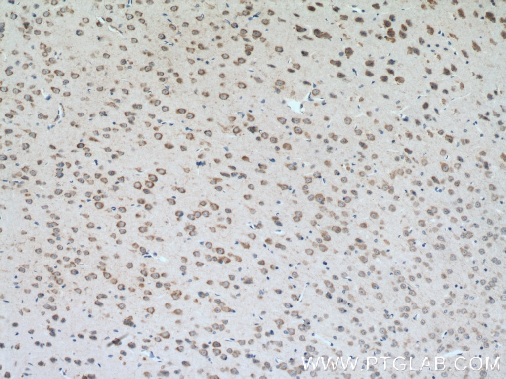 Immunohistochemistry (IHC) staining of mouse brain tissue using CLSTN3 Polyclonal antibody (13302-1-AP)