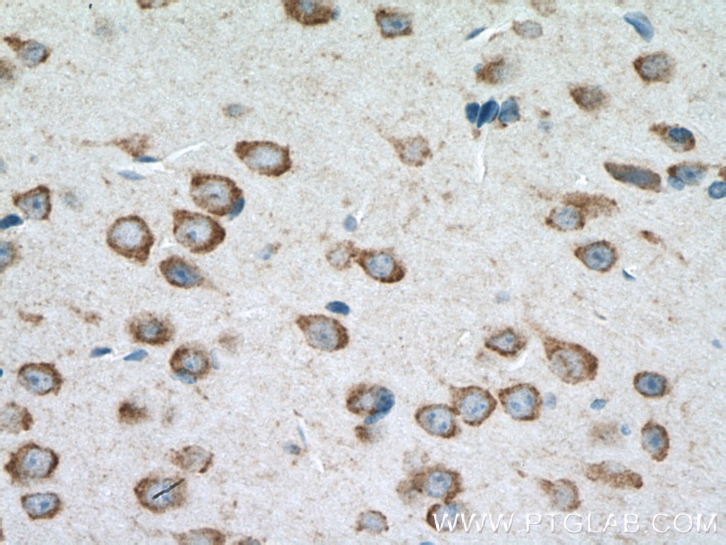 Immunohistochemistry (IHC) staining of mouse brain tissue using CLSTN3 Polyclonal antibody (13302-1-AP)