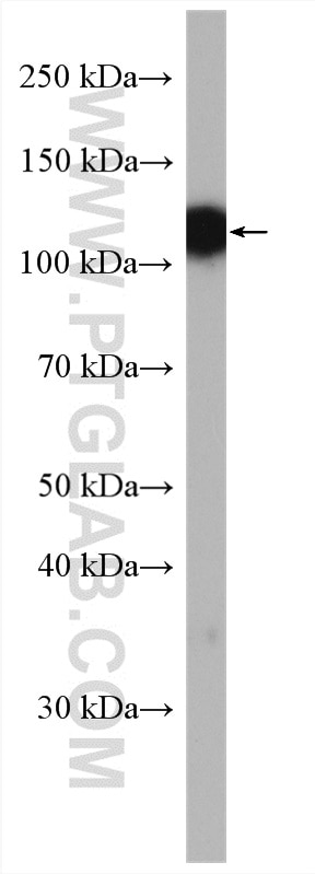 Western Blot (WB) analysis of pig brain tissue using CLSTN3 Polyclonal antibody (13302-1-AP)