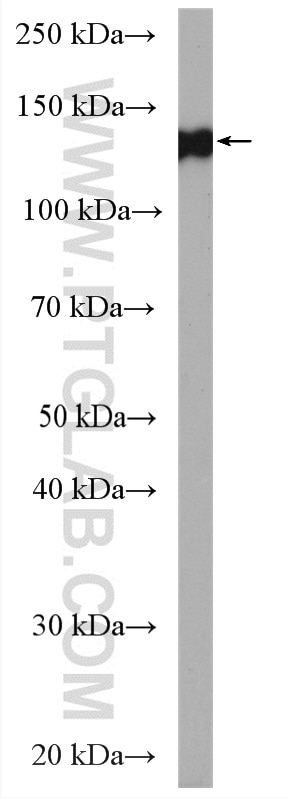 Western Blot (WB) analysis of mouse brain tissue using CLSTN3 Polyclonal antibody (13302-1-AP)