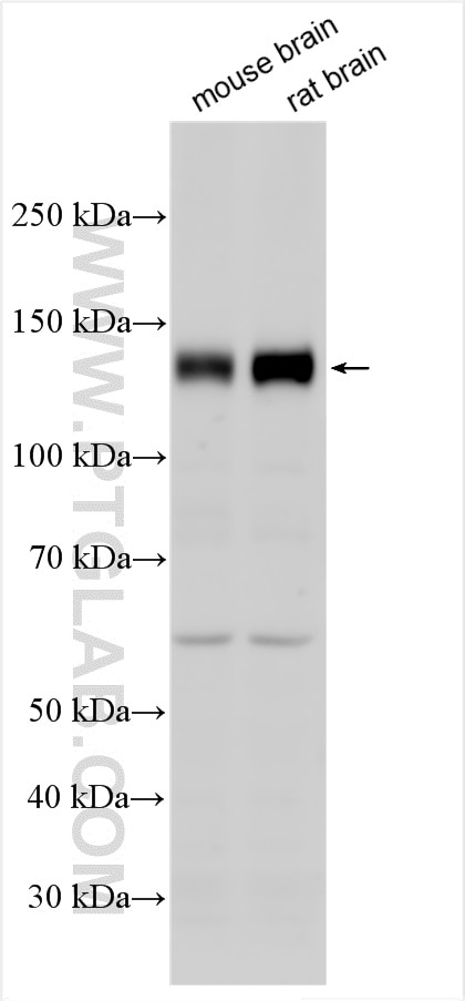 Western Blot (WB) analysis of various lysates using CLSTN3 Polyclonal antibody (13302-1-AP)