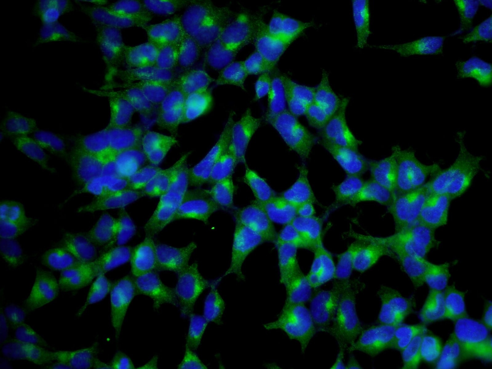 Immunofluorescence (IF) / fluorescent staining of HEK-293 cells using CLTA Polyclonal antibody (10852-1-AP)