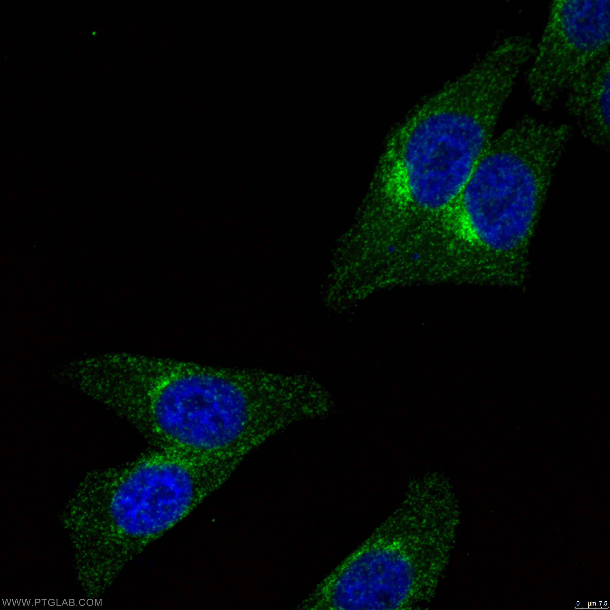 Immunofluorescence (IF) / fluorescent staining of HepG2 cells using CLTA Polyclonal antibody (10852-1-AP)