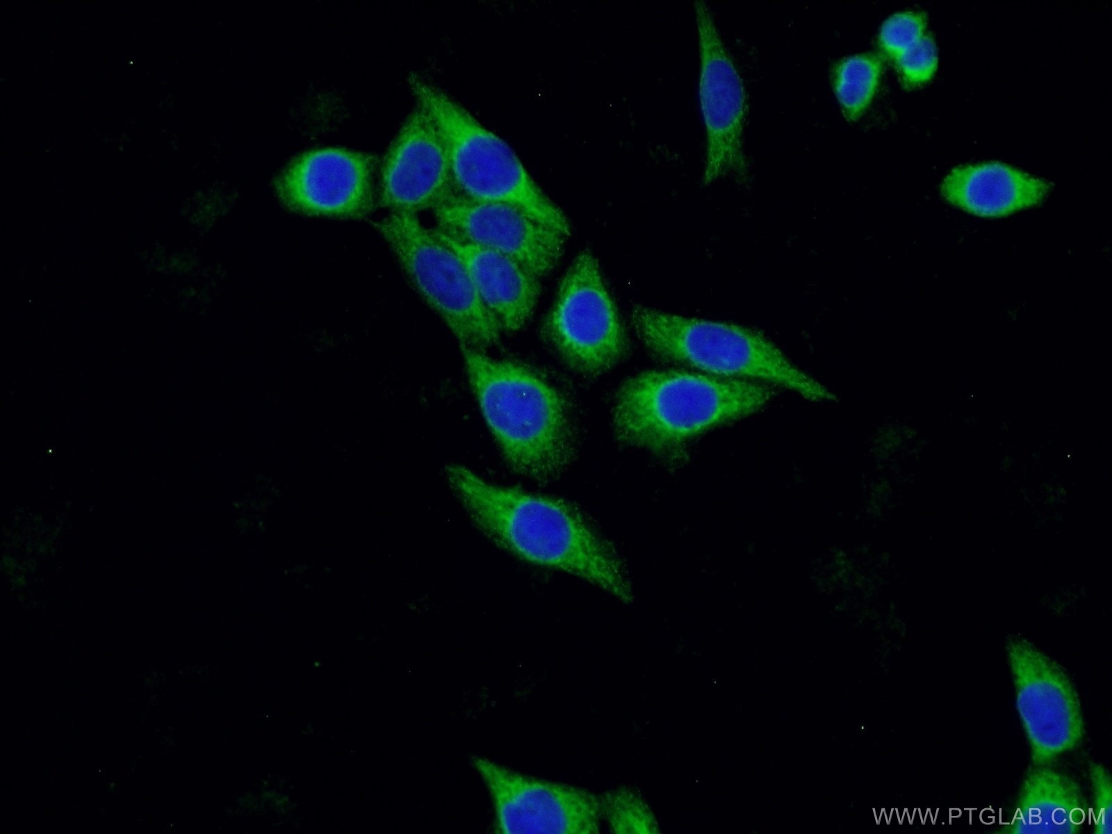 CLTA Polyclonal antibody