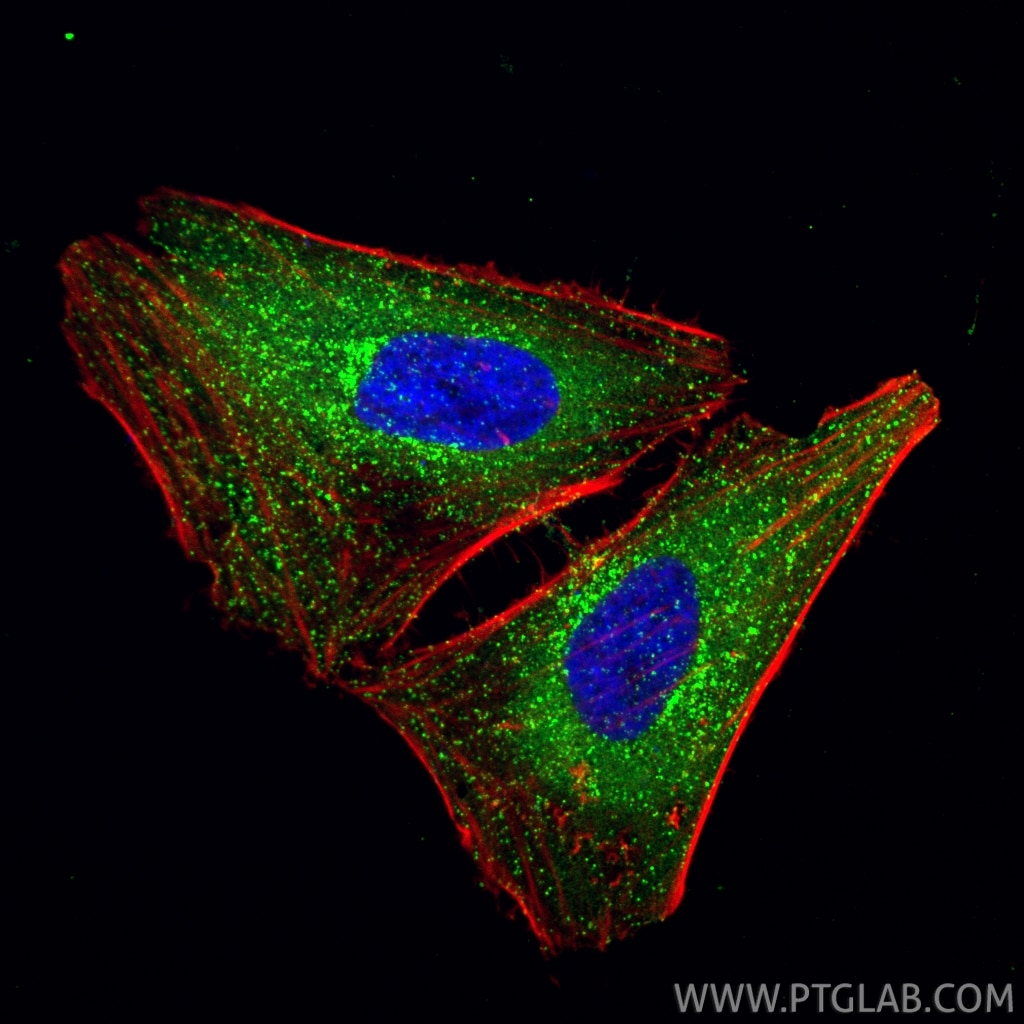 Immunofluorescent analysis of (4% PFA) fixed HeLa cells using CLTA antibody (10852-1-AP) at dilution of 1:1000 and CoraLite®488-Conjugated Goat Anti-Rabbit IgG(H+L) (SA00013-2), CoraLite®594-Phalloidin (red). Immunofluorescence (IF) / fluorescent staining of HeLa cells using CLTA Polyclonal antibody (10852-1-AP)