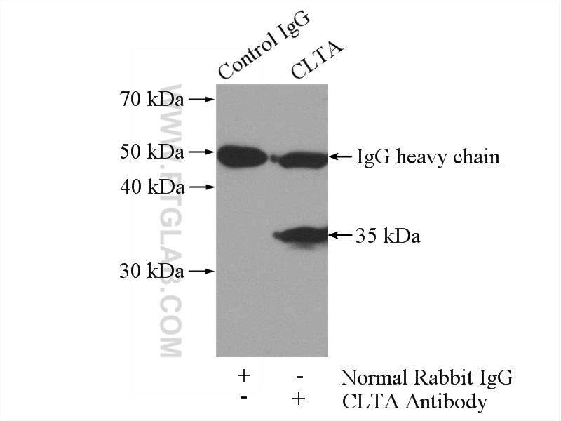 Immunoprecipitation (IP) experiment of mouse brain tissue using CLTA Polyclonal antibody (10852-1-AP)