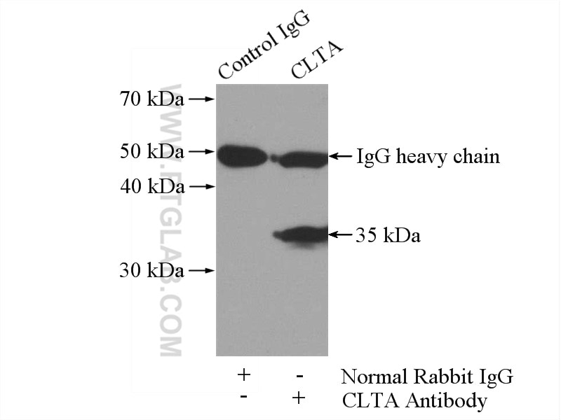 IP experiment of mouse brain using 10852-1-AP