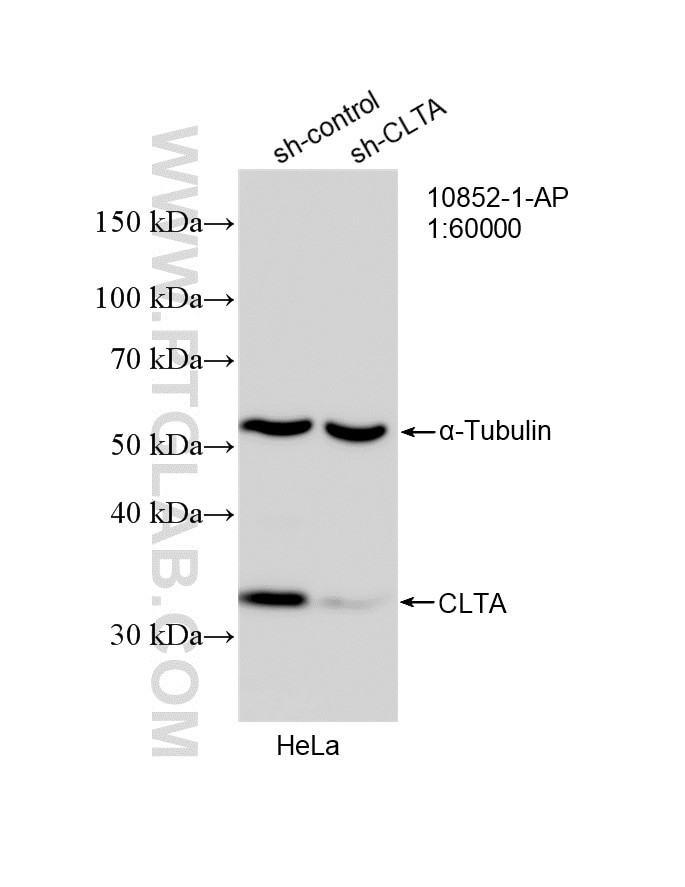 Western Blot (WB) analysis of HeLa cells using CLTA Polyclonal antibody (10852-1-AP)