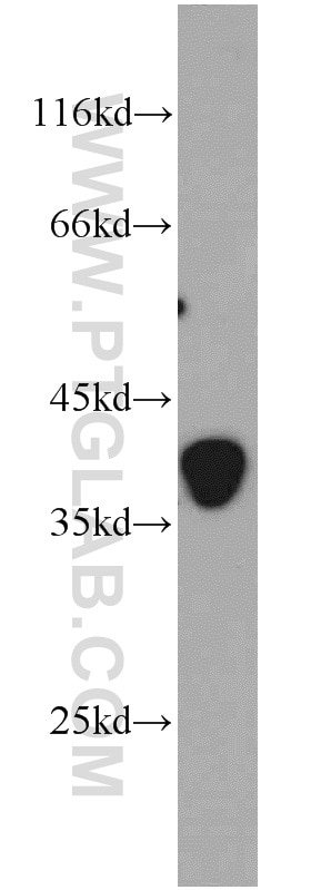 Western Blot (WB) analysis of mouse brain tissue using CLTA Polyclonal antibody (10852-1-AP)