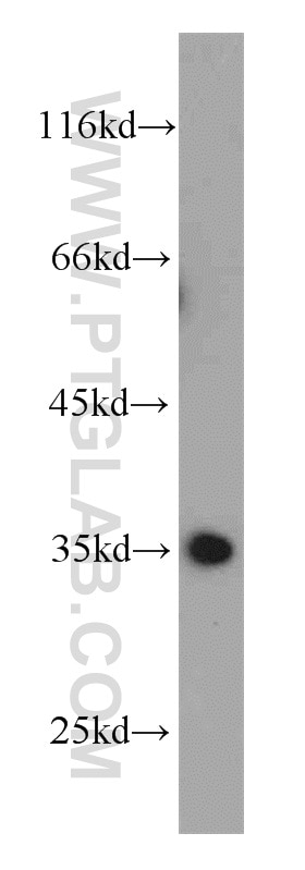 Western Blot (WB) analysis of HEK-293 cells using CLTA Polyclonal antibody (10852-1-AP)
