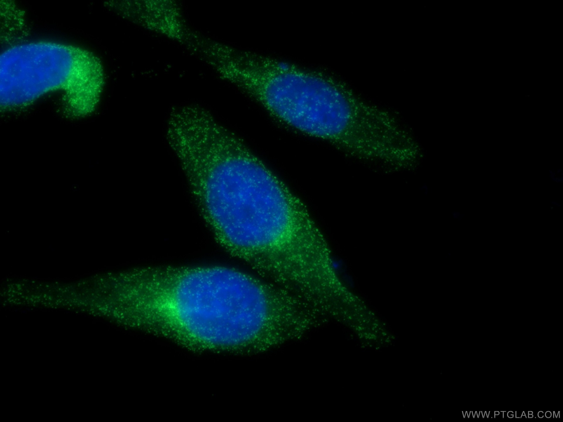 Immunofluorescence (IF) / fluorescent staining of HepG2 cells using CoraLite® Plus 488-conjugated CLTA Polyclonal anti (CL488-10852)