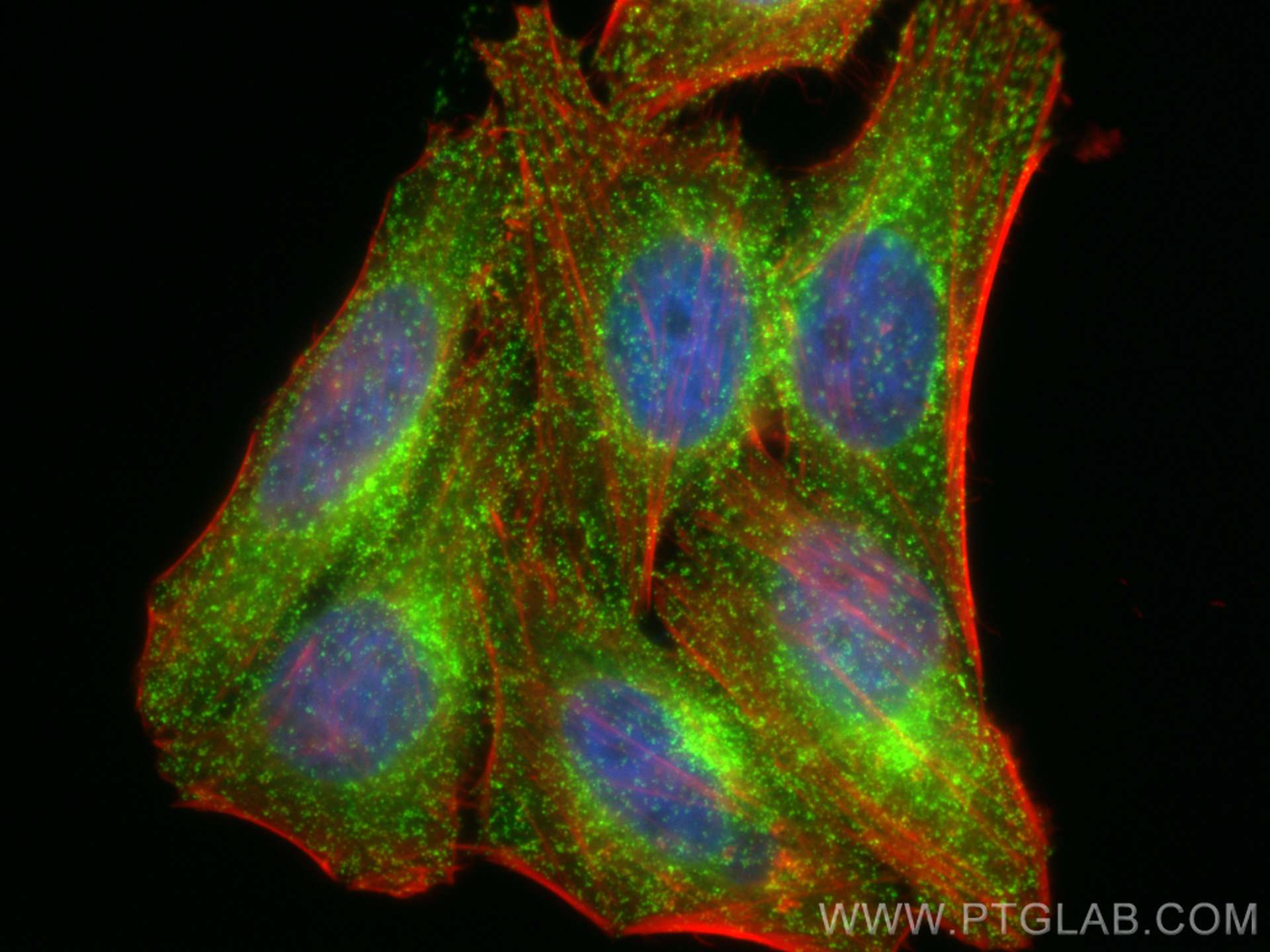 Immunofluorescence (IF) / fluorescent staining of HepG2 cells using CoraLite® Plus 488-conjugated CLTA Polyclonal anti (CL488-10852)