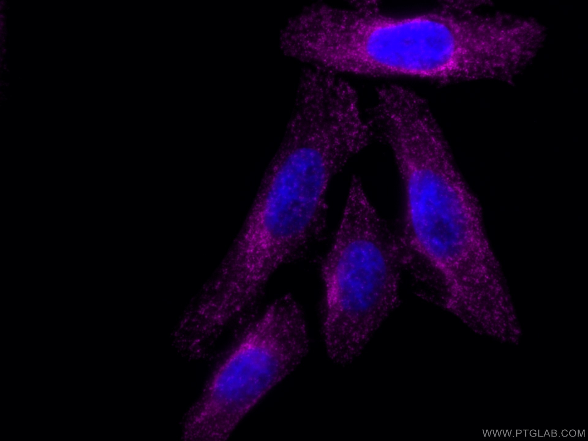 Immunofluorescence (IF) / fluorescent staining of HepG2 cells using CoraLite® Plus 647-conjugated CLTA Polyclonal anti (CL647-10852)