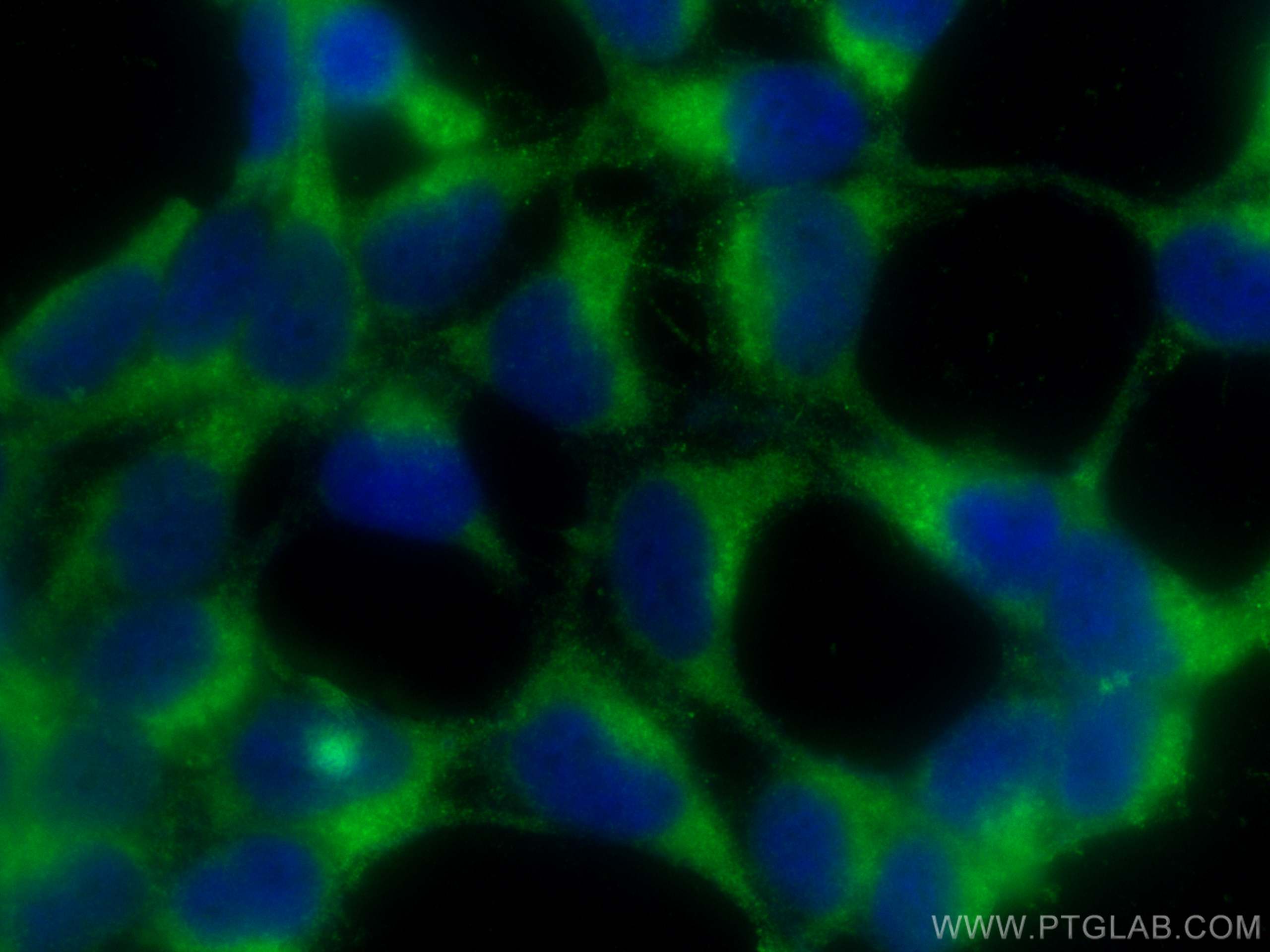 Immunofluorescence (IF) / fluorescent staining of HEK-293 cells using CLTB Polyclonal antibody (10455-1-AP)