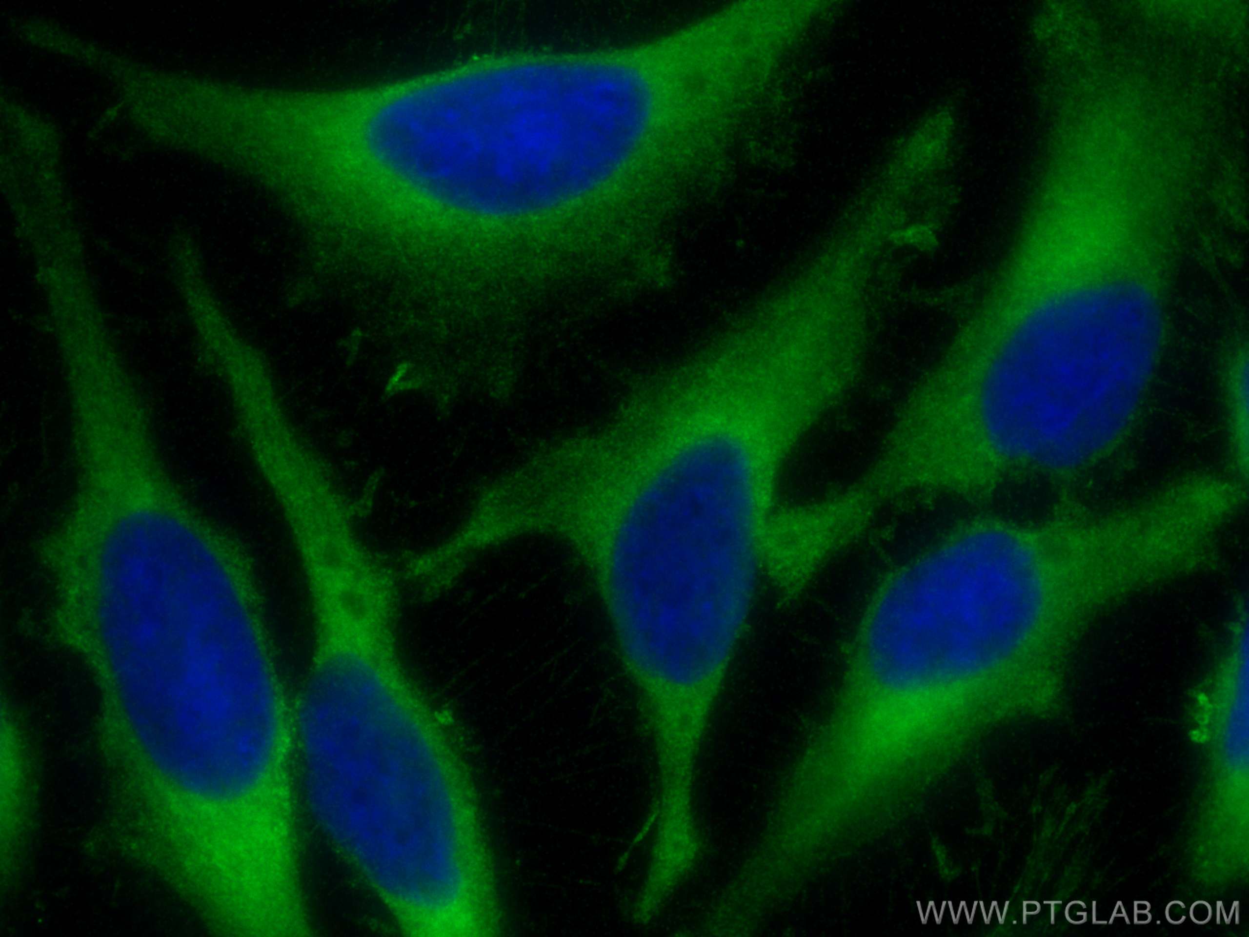 Immunofluorescence (IF) / fluorescent staining of HeLa cells using CLTB Polyclonal antibody (10455-1-AP)