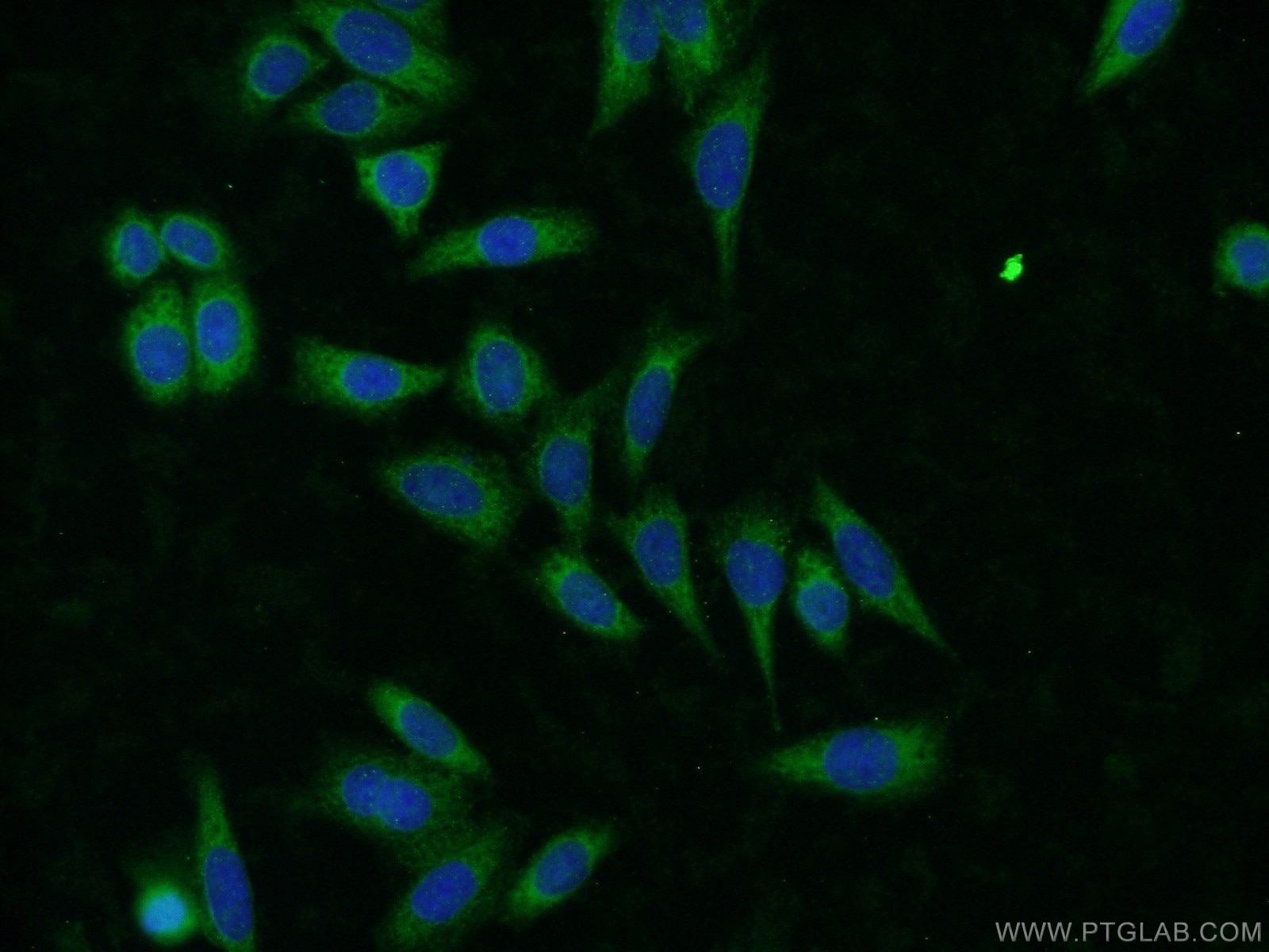 Immunofluorescence (IF) / fluorescent staining of HeLa cells using CLTB Polyclonal antibody (10455-1-AP)