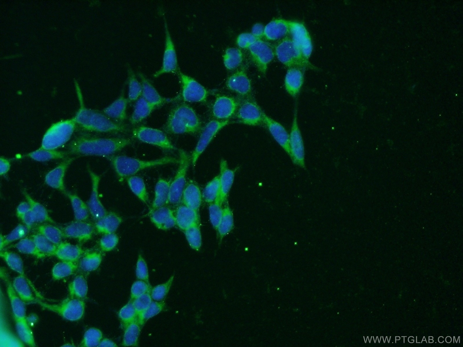 Immunofluorescence (IF) / fluorescent staining of HEK-293 cells using CLTB Polyclonal antibody (10455-1-AP)